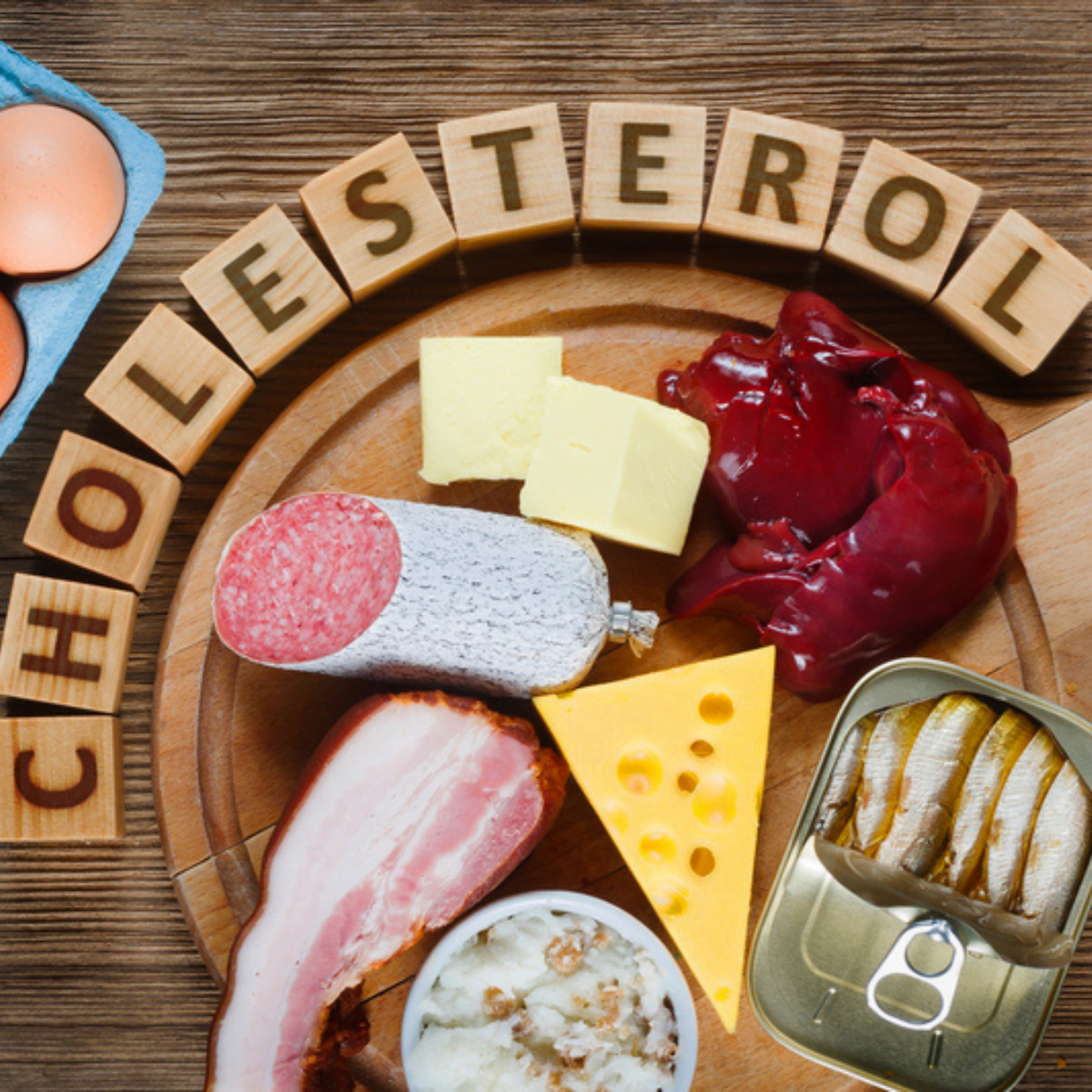 Kaip sumažinti cholesterolio kiekį kraujyje?